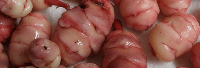 oca